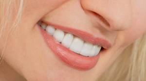 Bọc răng sứ có ảnh hưởng gì